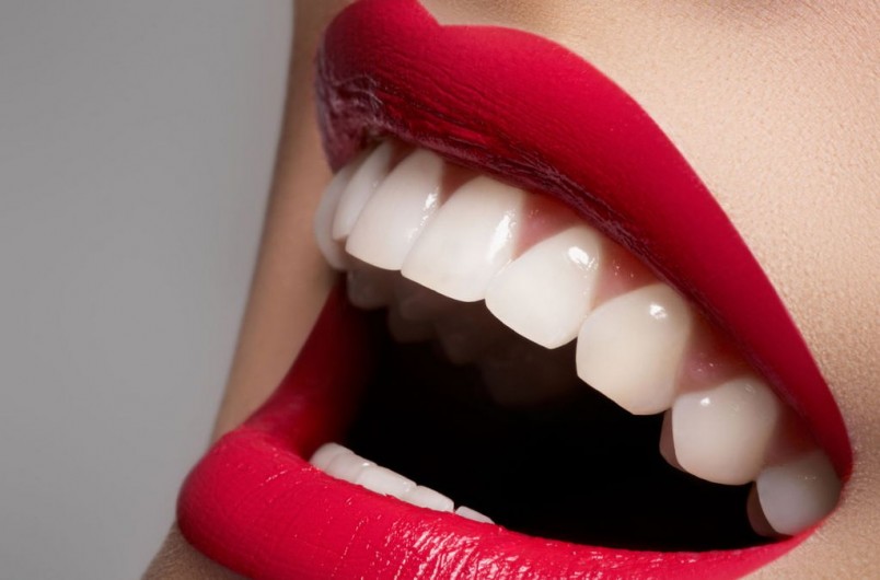 Домашняя процедура отбеливания зубов позволяет добиться результата за достаточно короткое время.