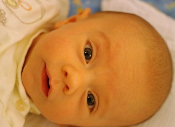 Физиологическая желтушка у новорожденного - вполне закономерное и совершенно безвредное состояние.
