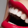 Домашняя процедура отбеливания зубов позволяет добиться результата за достаточно короткое время.