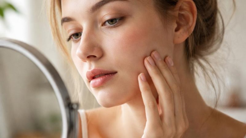Следы после прыщей: почему они остаются и что с ними происходит со временем
